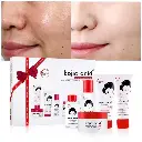 Guanjing_Kojic_Acid_Whitening_Anti_Aging_Skin_Care_Set_5Pcs_66_800x.webp