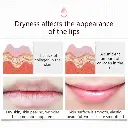 lipcare_5cefb52a-152a-4341-b3b7-04e06de97b84_800x.webp