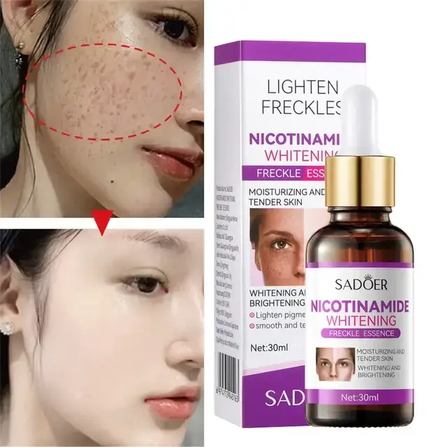 SADOERNiacinamideWhiteningFrecklesSerum30ml_640x.webp
